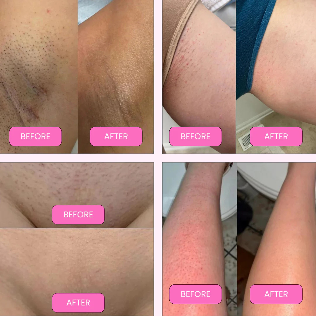 SkinLush™ Smooth Shaver 2.0