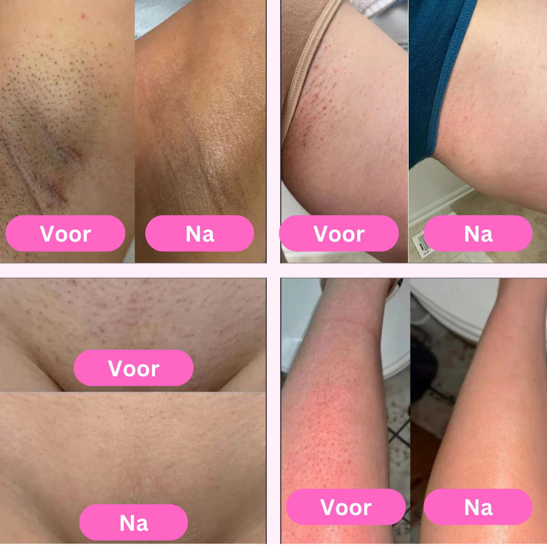 SkinLush™ Lady Shaver 2.0
