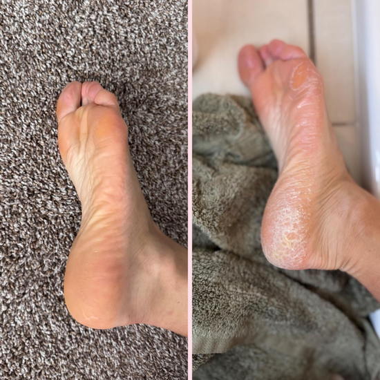 Skinlush™ Silk 3 Pro