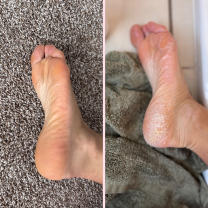 Skinlush™ Silk 3 Pro