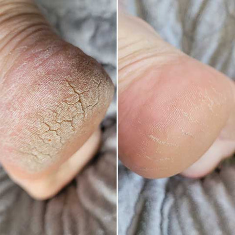 Skinlush™ Silk 3 Pro